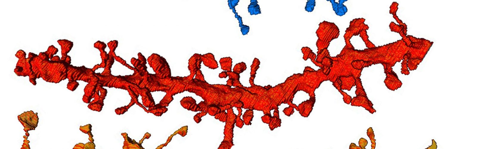 example of neuronal dendrites imaged in the CSC